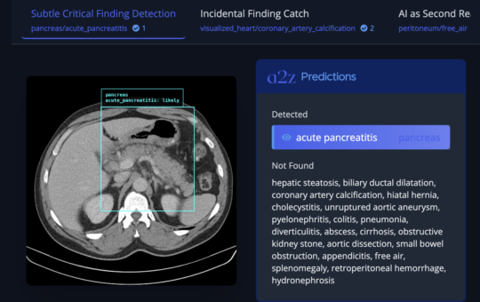 a2z Radiology AI Introduces a2z-1: An AI that Analyzes Abdominal-Pelvis CT Scans and Reports to Catch Potential Misses Across 21 Conditions